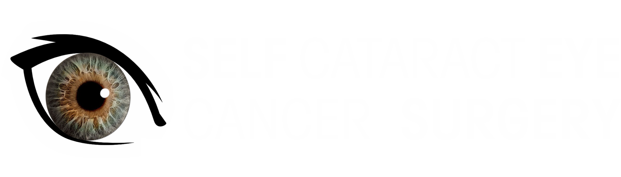 Self Cataract Eye Cancer Surgery